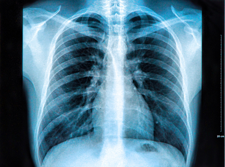 <h3>Understanding the Interaction Between the Skeletal and Respiratory Systems</h3>