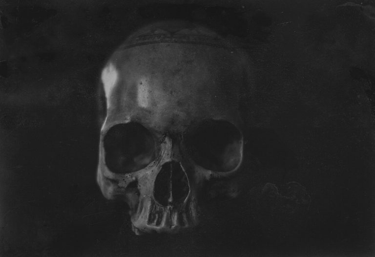 <h3>Varieties of Human Skull Shapes</h3>