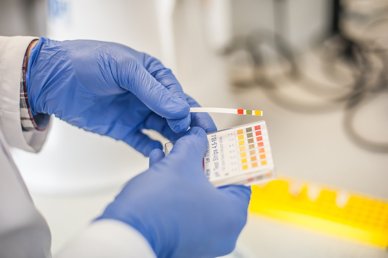 <h3>Calculating Total Alkalinity</h3> <br /><h4>Note: No need for numbers</h4>