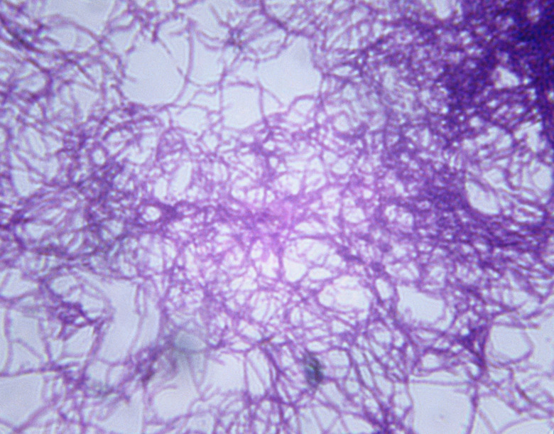 <h3>Understanding Ubiquity in Microbiology</h3>