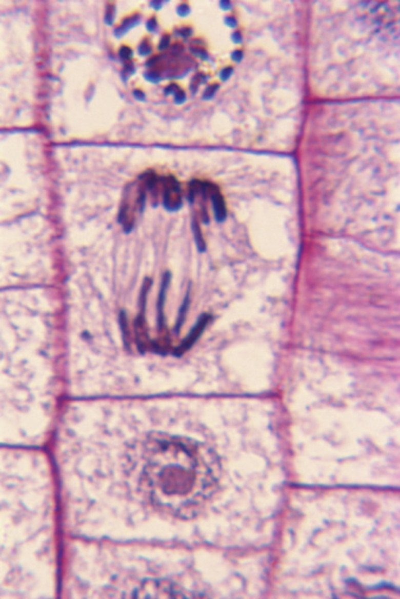 <h3>Identifying Stages of Mitosis in Cells Under a Microscope</h3>